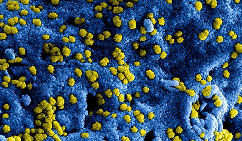 corona-virus-close-up